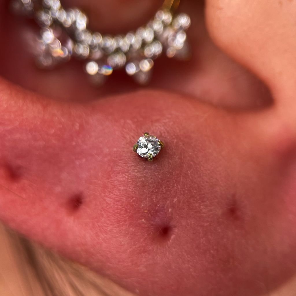 Upper Lobe