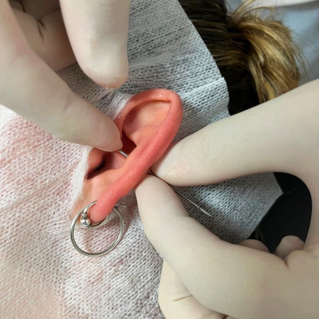 Esecuzione Conch